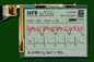 320*240 FSTN módulo LCD monocromo para la exploración médica positivo